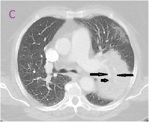 Figure C