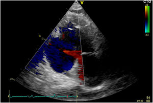 Fig. 2