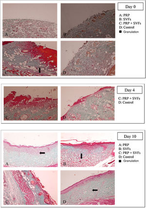 Colagen synthesis on post-wound days 0, 4, and 10 (hematoxylin–eosin, 40×).