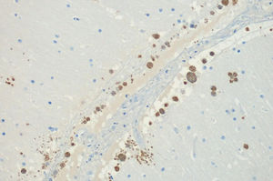 Técnica inmunohistoquímica positiva para protozoos (400×).