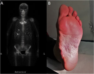 Figura 1