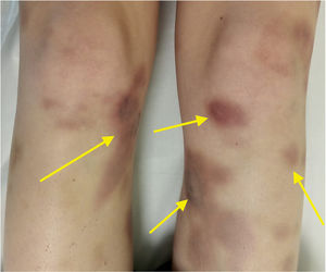 Fig. 1
