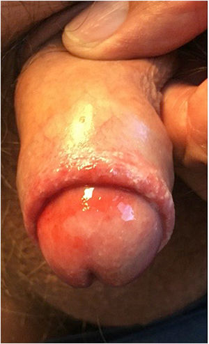 Figura 1