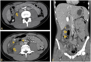 Fig. 1