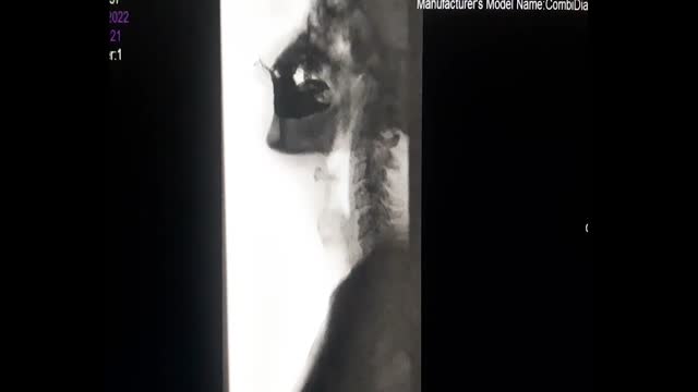 https://ars.els-cdn.com/content/image/1-s2.0-S2603924922000428-mmc1.mp4