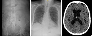 Initial abdominal X-ray, chest X-ray, cranial CT.