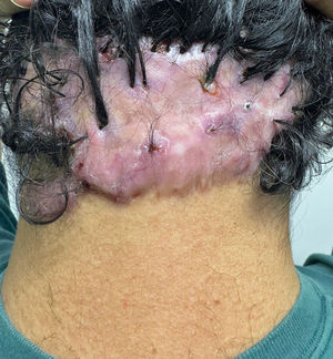 Clinical appearance of the patient.