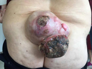 Figura 1