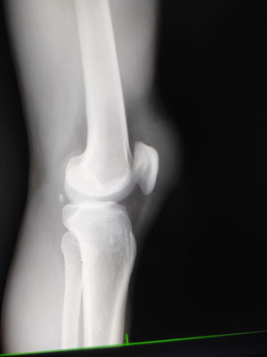 Radiografía de rodilla.