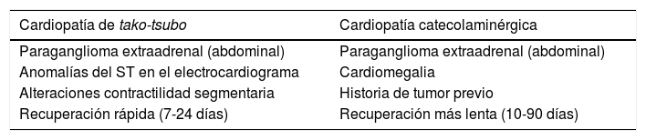 Tablas