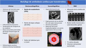 Principales hallazgos sugestivos (red flags) de amiloidosis cardiaca por transtirretina. Imágenes reproducidas con permiso de la Unidad de Cardiopatías Familiares e Insuficiencia Cardiaca del Hospital Universitario Puerta de Hierro. RMC: resonancia magnética cardiaca.