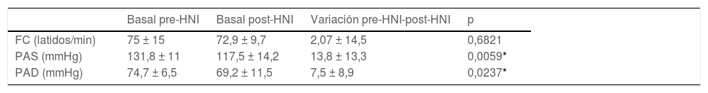 Tables
