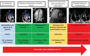 Algoritmo propuesto sobre el momento óptimo para plantear el intervencionismo (percutáneo o quirúrgico) sobre la insuficiencia tricuspídea. FEVD: fracción de eyección del ventrículo derecho; IC: insuficiencia cardiaca; NYHA: Clase funcional de la New York Heart Association; PSAP: presión sistólica de la arteria pulmonar; VD: ventrículo derecho.