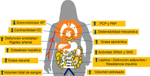 Fisiopatología del fenotipo diferenciado de la obesidad en la insuficiencia cardiaca con fracción de eyección conservada. AP: arteria pulmonar; PAP: presión arterial pulmonar; PCP: presión capital pulmonar; SNS: sistema nervioso simpático; SRAA: sistema renina-angiotensina-aldosterona; VD: ventrículo derecho.
