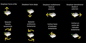 Sistema de inteligencia artificial que sirve de guía al operador para maniobrar la orientación de la sonda y adquirir los planos óptimos de ecocardioscopia en función de las imágenes observadas en tiempo real (Sistema Caption AI de Vscan Air SL). Figura traducida de la original, cortesía de GE HealthCare.