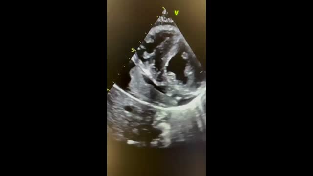 https://ars.els-cdn.com/content/image/1-s2.0-S2605153225001487-mmc1.mp4