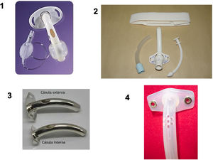 Diferentes tipos de cánulas de traqueostomía. 1) Cánula de plástico fenestrada y con balón de neumotaponamiento; 2) Cánula de plástico fenestrada sin balón; 3) Cánula de plata; 4) Cánula de silicona fenestrada.