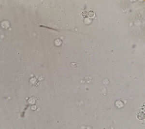 Trichomonas spp. en el centro de la imagen.
