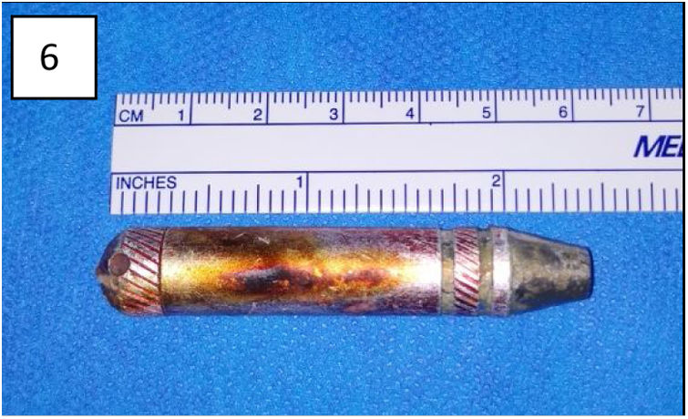 A 6cm Metal Crack Pipe Aspirated