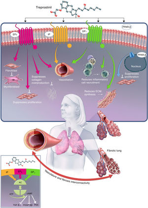 Impacto del treprostinil en la remodelación vascular, la sobreexpresión de citoquinas y el desarrollo de fibrosis pulmonar, a través de la activación de EP2, IP, DP1 y PPARβ para producir efectos antifibróticos18.