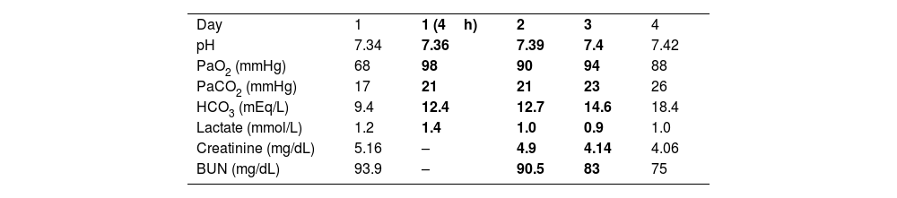 Tablas