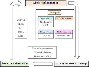 The vicious cycle hypothesis of bronchiectasis. CXCL-8: interleukin-8; IL-1β: interleukin-1 β; IL-17: interleukin 17; LTB4: leukotriene B4; MMP: matrix metalloproteinase; NE: neutrophil elastase; NET: neutrophil extracellular traps; ROS: reactive oxygen species; TNF-α: tumor necrosis factor α. Adapted from Chalmers et al.14 and Solarat et al.13