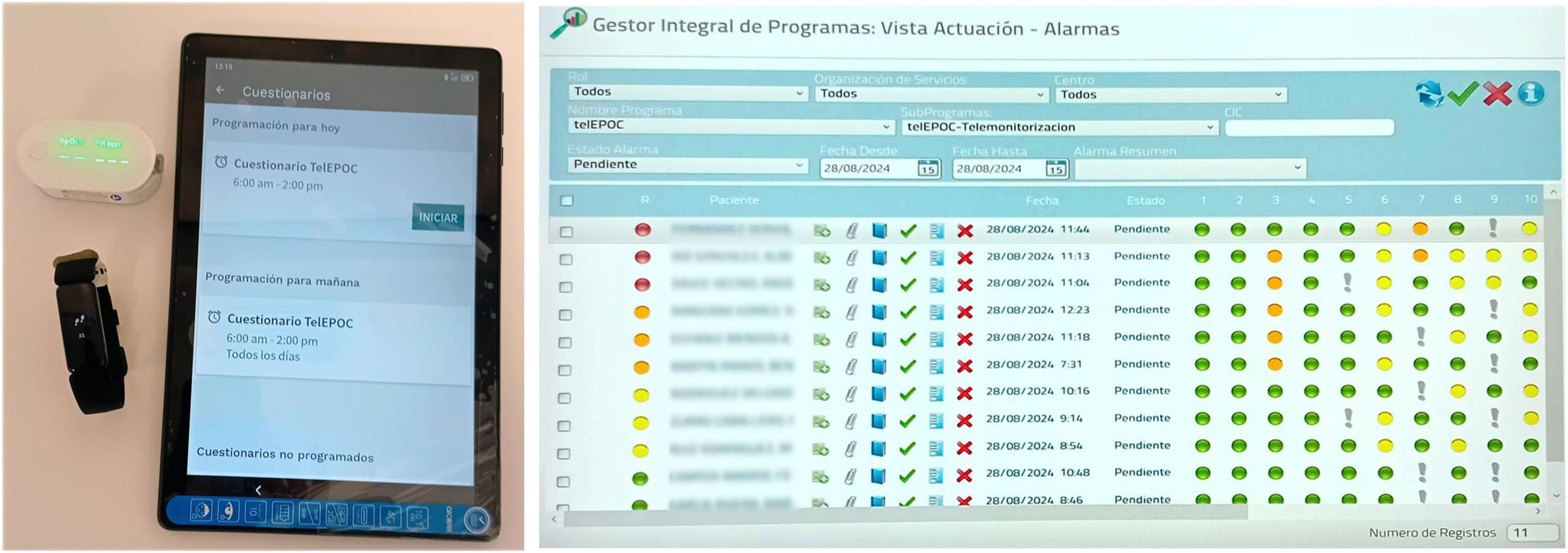 Telemonitoring Color Real-world Outcomes of a Telemonitoring Program (telEPOC) for Patients ...