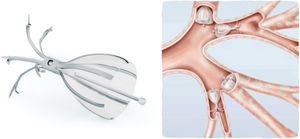 Spiration system valves: illustration of the valve morphology with its most proximal portion (left) and its mechanism of action (right).