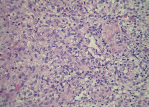 Histopatologia - coloração com Hematoxilina & eosina, 40x.