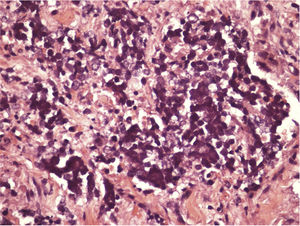 Detalhe das células de Merkel.