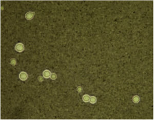 A coloração com nanquim evidenciou as características leveduras encapsuladas com brotamentos, circundadas por halos (40×).