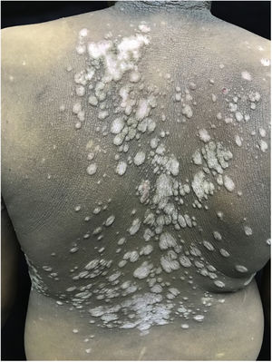 Detalhe das lesões.