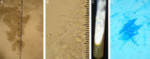 (A e B), Exame micológico direto em microscopia óptica clareado com KOH 20%. Aumento de 100×, apresenta aglomerados de hifas septadas e aumento de 400×, identifica as estruturas de hifas septadas hialinas. (C e D), Cultura para fungos, evidencia colônia filamentosa branca e agar pigmentado de amarelo e microcultivo com hifas septadas hialinas ao fundo e três macroconídeos ao centro (azul de algodão, 400×).