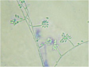 Micromorfologia da colônia a 25°C evidencia hifas hialinas septadas, conidióforos que originam conídios primários hialinos em arranjo de margarida (azul de algodão, 400×).