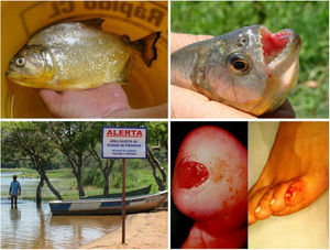 Balneário (município de Adolfo‐SP, 21°09’56“S, 49°43’03”W) em área represada do rio Tietê. Acidentes por ataque de piranha em banhistas: úlceras em saca‐bocados nos pés. Detalhes do animal adulto e dos dentes triangulares (Serrasalmus maculatus).