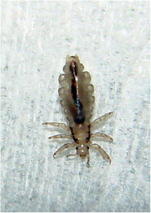 Pediculus humanus capitis. Agente da pediculose do couro cabeludo, endêmico em grandes aglomerados urbanos.