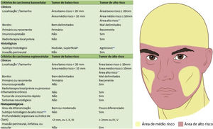 Indicações da cirurgia micrográfica de Mohs para carcinoma basocelular e carcinoma espinocelular. *Para mais detalhes das áreas de risco, ver Figura 4. **Área de alto risco torna o tumor de alto risco independentemente do tamanho. #Outros tumores de subtipo histopatológico não agressivo incluem ceratótico, infundibulocístico e fibroepitelioma de Pinkus. ##A presença de subtipo infiltrativo, micronodular, esclerodermiforme ou metatípico em qualquer porção do tumor o torna de alto risco. ###Subtipos acantolítico e desmoplásico.
