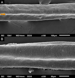 Microscopia eletrônica de varredura – exame dos cílios mostrando canais na haste pilar. (A), Pequeno aumento (180×). (B), Médio aumento (330×).