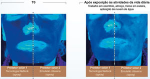 Ilustração da capacidade de absorção da radiação UV de dois filtros solares avaliados por fotografias obtidas sob luz UV. (Fonte: Moyal D et al., 202031).