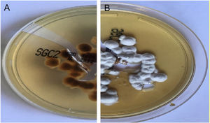 Cultura em ágar Sabouraud dextrose da primeira paciente. (A), Reverso da colônia de cor vermelho‐amarelada. (B), Vista frontal com colônias pulverulentas brancas. Esses aspectos são sugestivos de T. rubrum.