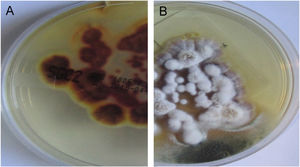 Cultura em ágar Sabouraud dextrose da segunda paciente. (A), Reverso da colônia de cor marrom‐amarelada. (B), Vista frontal com colônias pulverulentas brancas. Esses achados são compatíveis com T. rubrum.