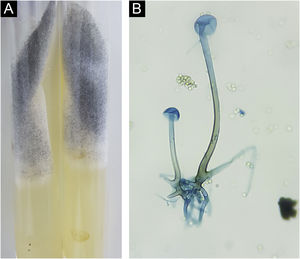 Rhizopus microsporus. (A), Colônia composta de micélio algodonoso esbranquiçada e micélio aéreo granuloso enegrecido. (B), Microcultivo evidenciando hifa cenocítica com rizoides, esporangióforo e esporângios vazios. Notam‐se presença de esporangiósporos ao redor da estrutura (Azul de algodão, 400x).