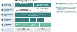 Critérios diagnósticos de epidermólise bolhosa adquirida (EBA).8 IFD, imunofluorescência direta; IFI, imunofluorescência indireta; NC, domínio não colagênico; IEM, imunoeletromicroscopia eletrônica; FOAM, fluorescence overlay antigen mapping – mapeamento de antígenos por sobreposição de imunofluorescência. O fluxograma para o diagnóstico de EBA baseia‐se na correlação entre o exame dermatológico e os resultados dos estudos complementares, uma vez que não há achado clínico ou laboratorial que isoladamente possibilite a confirmação diagnóstica. Atualmente se sugere considerar EBA como hipótese diagnóstica nos casos em que há fragilidade cutânea com formação de cicatriz e milia (forma mecanobolhosa) ou placas urticariformes com bolhas (forma inflamatória). O quadro clínico correlaciona‐se com os achados do exame anatomopatológico: a forma mecanobolhosa apresenta uma clivagem subepidérmica pauci‐inflamatória, enquanto na forma inflamatória observa‐se uma dermatose bolhosa dermoepidérmica rica em neutrófilos. O caráter autoimune da doença pode ser confirmado pelo exame de imunofluorescência direta, que possibilita a visualização de depósitos de imunocomplexos principalmente por IgG, seguida por C3, IgA e IgM. Além disso, a pesquisa de autoanticorpos circulantes pode ser realizada por meio de diferentes métodos diagnósticos como imunoeletromicroscopia eletrônica indireta, ELISA, imunofluorescência indireta (substrato de epitélio escamoso estratificado normal ou biochip) e Western blot. Quando os exames previamente mencionados resultam negativos ou inconclusivos, a pesquisa de autoanticorpos in situ pode ser realizada por imunoeletromicroscopia eletrônica direta, padrão do serrilhado da imunofluorescência direta ou mapeamento de antígenos por sobreposição de imunofluorescência (FOAM). No entanto, como essas técnicas encontram‐se mais disponíveis para pesquisa, na prática clínica costuma‐se utilizar a imunofluorescência direta ou indireta com salt‐split skin como método para demonstrar os depósitos de imunocomplexos no lado dérmico da clivagem, onde se localiza o colágeno VII.