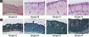 Alterações histopatológicas da pele do dorso de camundongos sob diferentes doses de radiação UVB. Consulte a figura A para coloração H&E e a figura B para coloração de Masson. A dose de radiação do Grupo A é de 0mJ/cm2; a dose de radiação do Grupo B é de 90mJ/cm2; a dose de radiação do Grupo C é de 180mJ/cm2; a dose de radiação do Grupo D é de 360mJ/cm2. As barras de escala correspondem a 100μm.