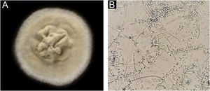 Trichophyton tonsurans. (A) Cultura microbiológica. (B) Hifas finas e septadas com clamidoconídios e múltiplos conídios dispostos de modo alternado e espelhado.
