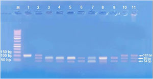 Imagens de eletroforese em gel de agarose para os genótipos da IL‐17A, genótipo GG, bandas 3, 4, 5, 6, 7 e 9; genótipo AG, bandas 2, 10 e 11; genótipo AA, bandas 1 e 8.