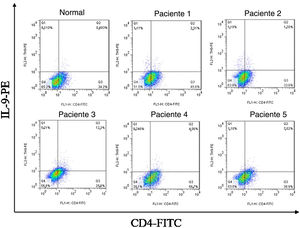 A proporção de células T CD4+IL‐9+ em CMSP de pacientes com ES foi significativamente maior do que a dos controles saudáveis.