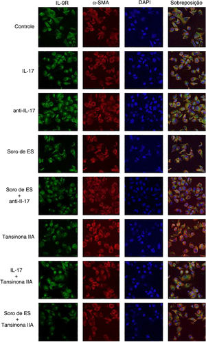 O anticorpo neutralizador de IL‐17 e a tansinona IIA inibem a expressão de IL‐9R em CMLVD. α‐SMA, fluorescência vermelha; IL‐9R, fluorescência verde.