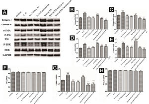 A expressão de várias proteínas relacionadas à fibrose e proteínas relacionadas à via de sinalização em CMLVD funcionalmente ativadas foi detectada por Western blotting. (A) Bandas imunorreativas de Western blotting de várias proteínas. A IL‐17 promove a expressão de várias proteínas em CMLVD, que é inibida pela tansinona IIA. (B–H) Os resultados de Western blotting de colágeno I, colágeno III, α‐SMA, P‐P38, P‐ERK e ERK são expressos na forma de gráficos estatísticos.
