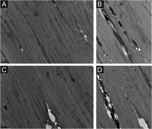 Microscopia eletrônica de transmissão ‐ controle normal com um arranjo paralelo de linhas escuras com bandas largas menos eletrodensas (a e b). Pequenas cavidades foram observadas, principalmente nas linhas escuras (b‐d). Essas cavidades ocorrem espontaneamente (b e d), ou em áreas onde os melanossomas estão inseridos (c e d; 15.000×).